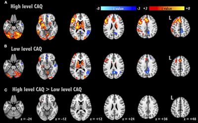 Think Hard or Think Smart: Network Reconfigurations After Divergent Thinking Associate With Creativity Performance